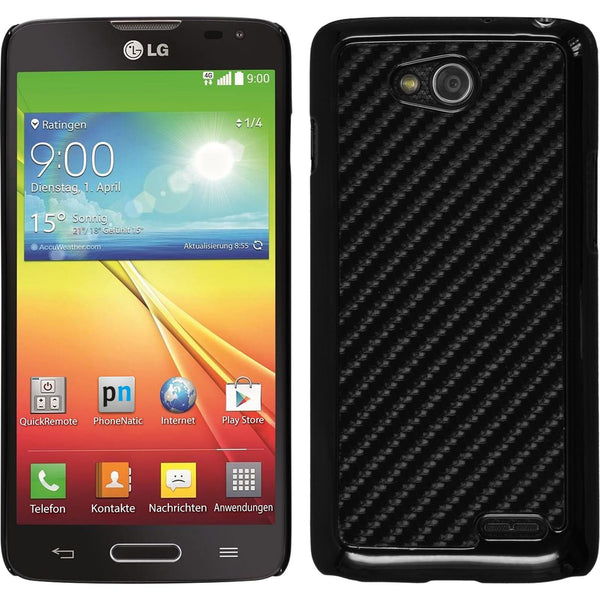Hardcase für LG L90 Carbonoptik schwarz