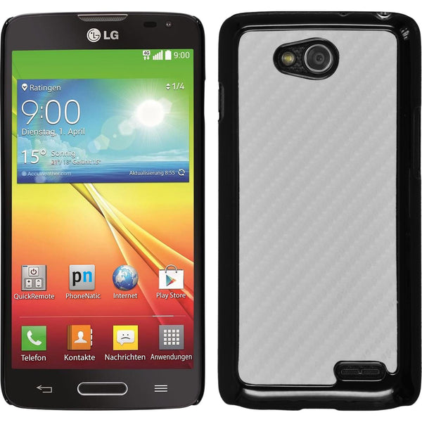 Hardcase für LG L90 Carbonoptik weiß